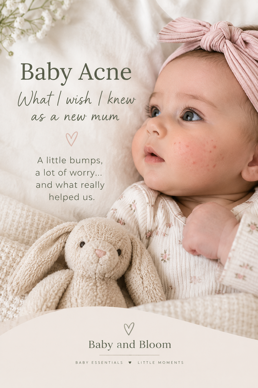 Baby Acne: What I Wish I Knew as a New Mum 🤍