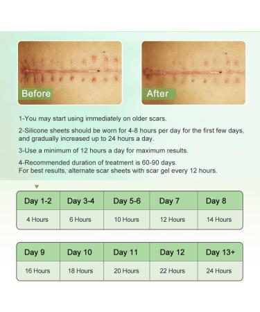 Silicone Scar Sheets 4.6cm x 4m | Medical Grade Scar Tape