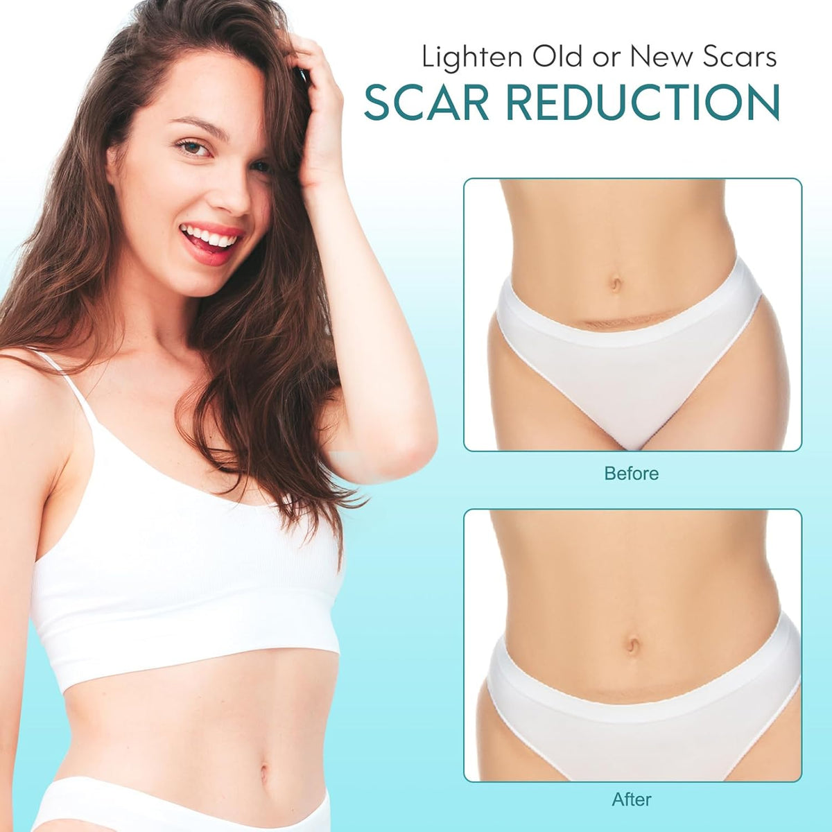 Silicone Scar Sheets 4.6cm x 4m | Medical Grade Scar Tape